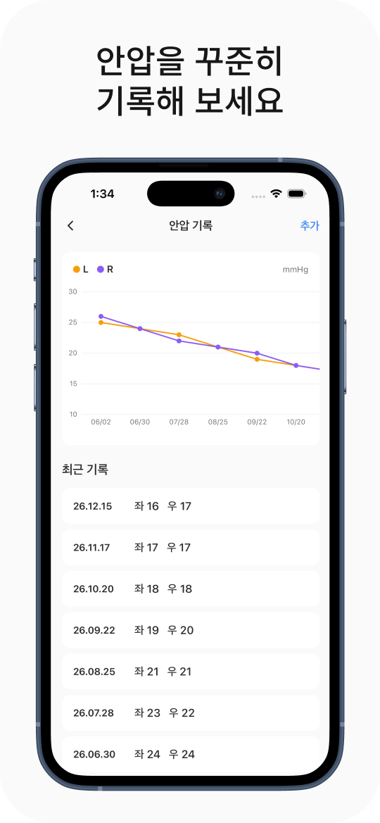 안압을 꾸준히 기록해 보세요